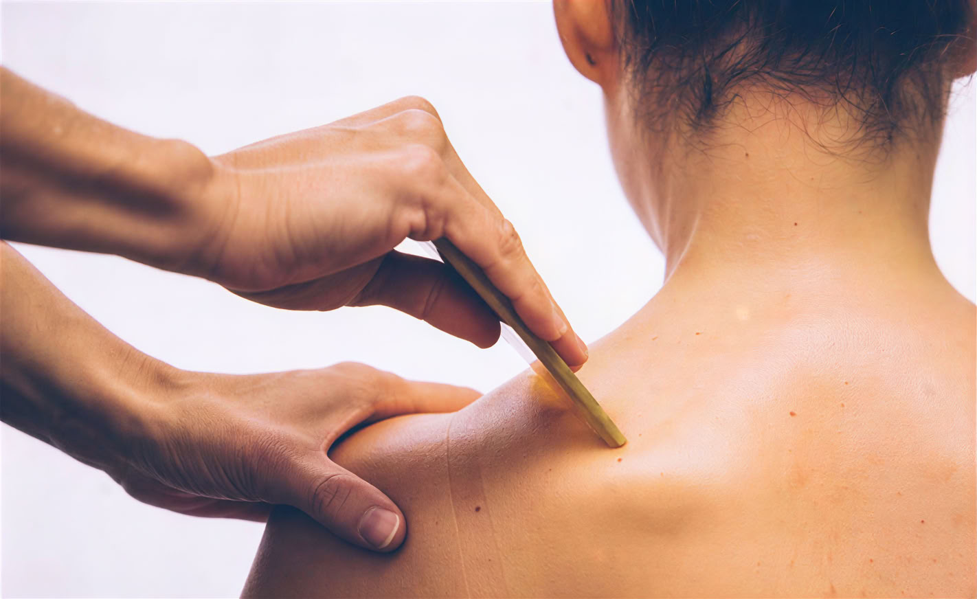 Gyvybės puoselėjimas LA • Akupunktūra ir kinų medicina