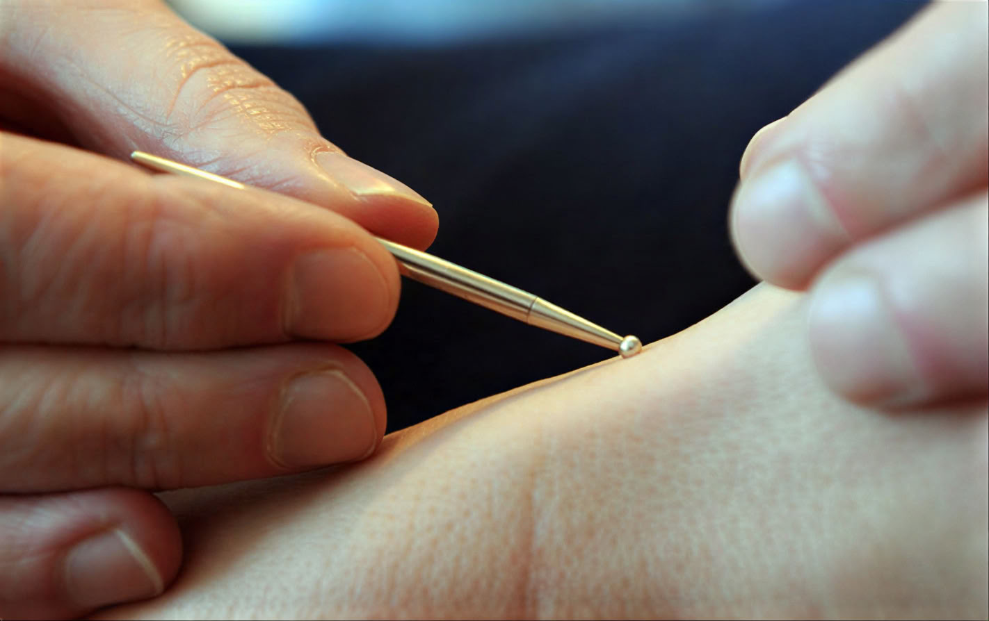 Gyvybės puoselėjimas LA • Akupunktūra ir kinų medicina